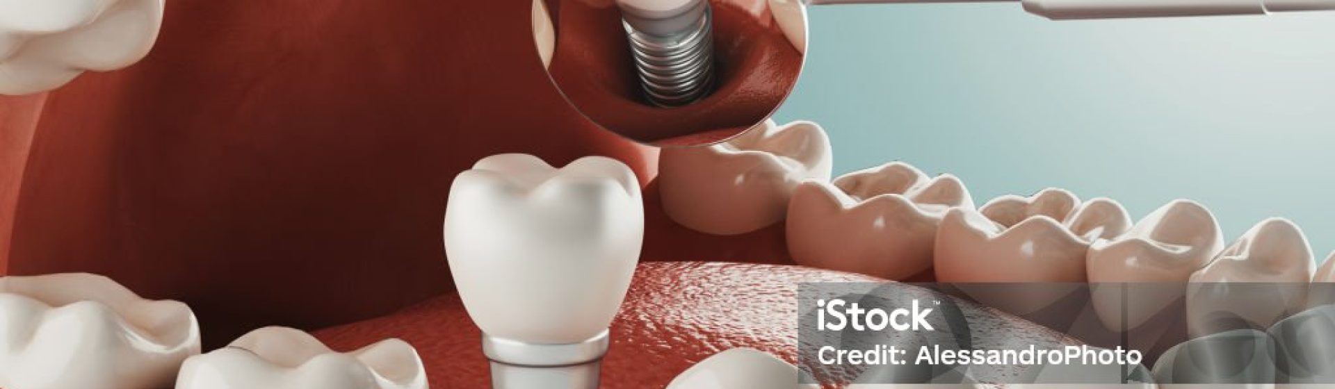 Dental care, modern clinic, 3d rendering, concept